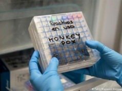 Nóng: Đức ghi nhận ca mắc đậu mùa khỉ đầu tiên ở trẻ em