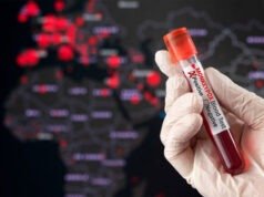 Kiểm tra nước thải ở Praha để tìm bệnh đậu mùa ở khỉ cũng như Covid