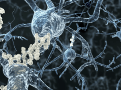 Liên minh châu Âu lần đầu phê duyệt thuốc điều trị Alzheimer: Hy vọng mới, nhưng chỉ cho số ít bệnh nhân